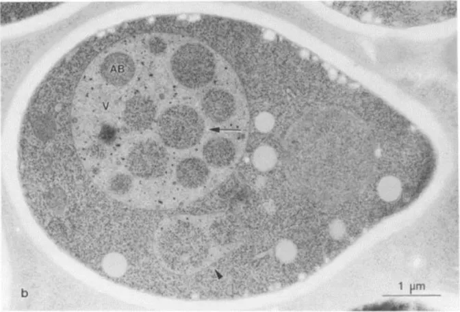 13. ábra Autofág testek élesztősejtben. a és b: kontroll sejtek vakuólájában nincsenek szemcsékként megjelenő  autofág testek (AB) (a és g: fáziskontraszt, b és h: úgynevezett DIC kép, (azaz Nomarski optikával, Differenciál  Interferencia Contrast mikroszk