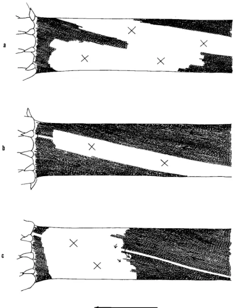 received rather severe injury, as is shown schematically in Fig. 4. Figure  4 shows the normal state of the cortical gel layer