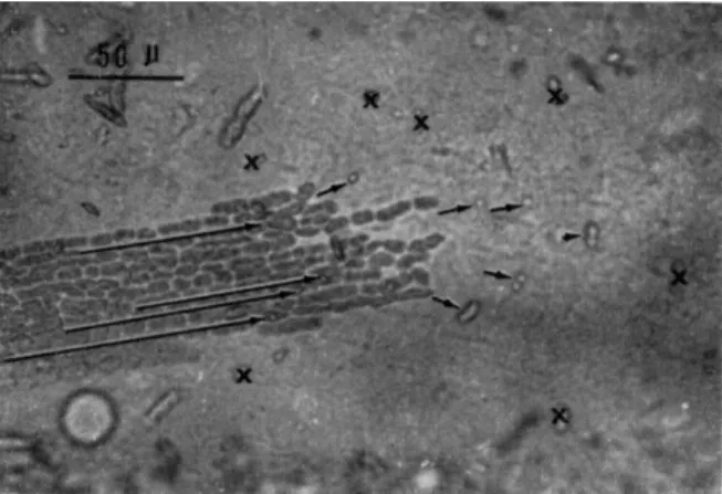 FIG. 3. Surface view of a part of the cortical gel layer of an internodal cell after  centrifugation