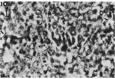FIG. 6. Protoplasmic fibrils (arrows) of Physarum polycephalum after glycerine  extraction (72 hr) of a protoplasmic drop, followed by osmium-chromium fixation,  (a) Paraffin wax embedding; section of 3-5 μ thickness; phase-contrast microscope; 