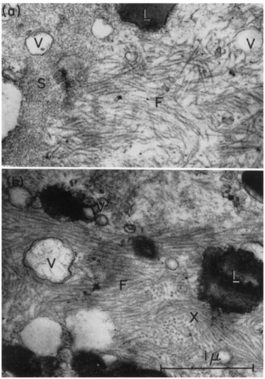 FIG. 5. Electron micrographs of the contracted gel obtained from extract I after  the addition of  A T P 