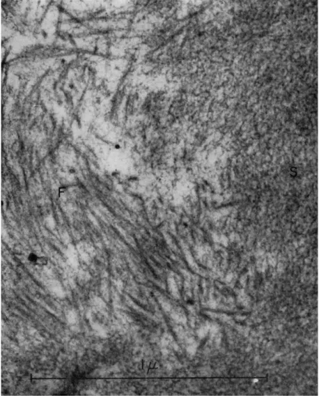 FIG. 6. Electron micrograph of spongy region (S) and fibers (F) of gel prepared  as in Fig