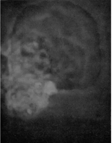 FIG. 9. Vannella miroides (see p. 202). (A)-(C)  T h e development of a radiate, waving  pseudopod by an actively locomotive individual, plotted from 3000 frames of motion  picture film, photographed at 14 frames/sec