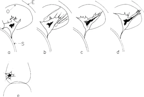 FIG. 7. Semischematic drawings of a larva in profile, ventral side to the left, show- show-ing the rounded esophagus, O, and the left coelom sac which extends backward along  the esophagus by means of pseudopods and finally forms a tube, the primary  pore-