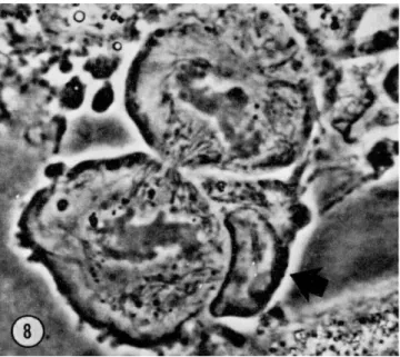 FIG. 8. Mitosis of a plasmablast. Emperipolesis by a lymphocyte inhibits bubbling  of the two daughter cells