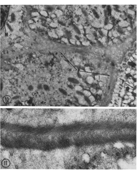 FIG. 10. A survey electron micrograph of Isotricha prostoma including portions  of the pellicle (P) and macronucleus (M)