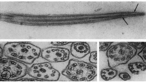 FIG. 7.  T h e structure of the tips of cilia.  T h e upper micrograph from Isotricha  sp
