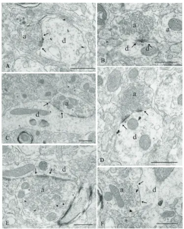 Figure  2.  Electron micrographs  show soluble guanylyl-cyclase   α1-immunoreactive  (sGCα1-IR) axons  (A-D), dendrites (E,  F) and a  neuronal  perikaryon (G) in the  paraventricular nucleus, in mice