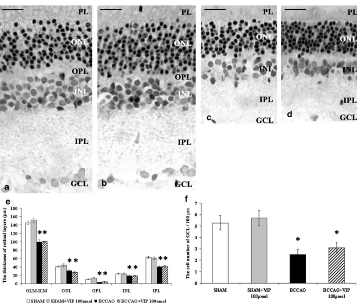 Fig. 1 Light microphotographs of representative retinal sections: sham- sham-operated (a), sham+100 pmol VIP-treated (b), BCCAO-damaged (c), and BCCAO+100 pmol VIP-treated retina (d)