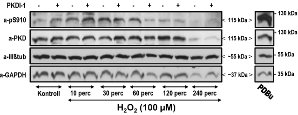 10. ábra PKDI-1 és Gö 6976 hatása a PKD oxidatív stressz által előidézett aktivációjára (A) 100 µM H 2 O 2
