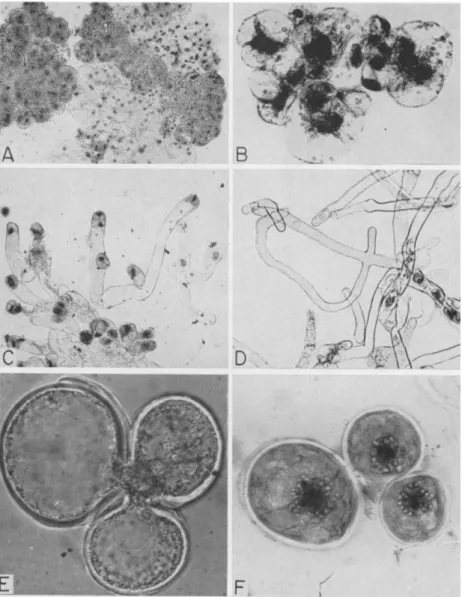 FIG. 6. Characteristics of haploid tissues derived from pollen: A, squash prepara- prepara-tion of Ginkgo tissue; B, cells of tissue from Ephedra pollen from Konar (1963); C-D,  Taxus tissue showing pollen-tube type cells with nuclei often located terminal