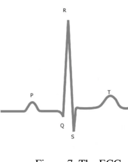 Figure 7. The ECG. 