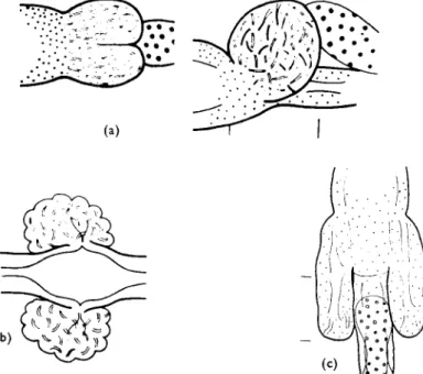 FIG. 5. Oesophageal-intestinal transition and diverticula. (a) Buccholzia appendiculata,  dorsal and lateral views, (b) Bryodrilus ehlersi, lateral view, (c) Henlea similis, dorsal view