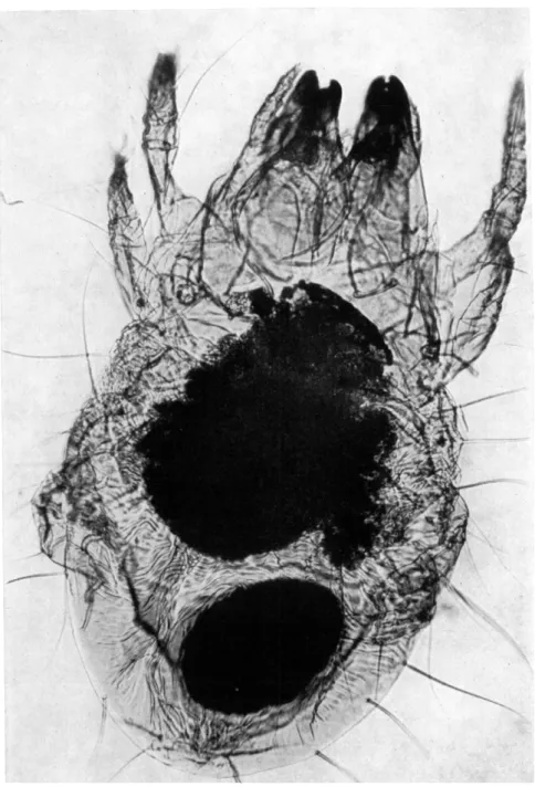 FIG. 4. Tritonymph of a cryptostigmatid mite (Hermannia sp. ?) taken from lenticel of fallen  yellow birch twig at Imp Lake, Michigan, U.S.A