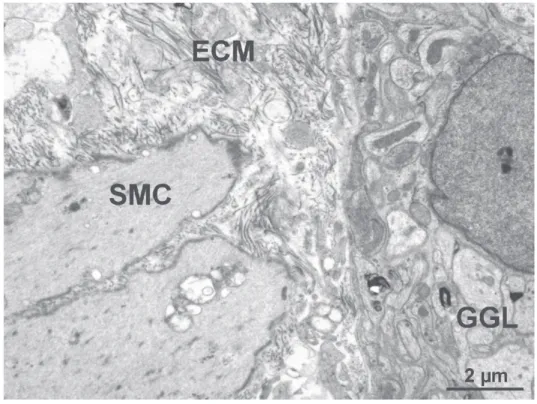 Figure 4 Representative electron micrograph of the rat colon in a strictured area  after 120 days of TNBS treatment