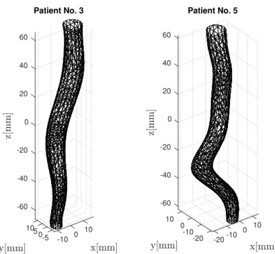 Figure 1: 3D mesh models of a non-branching vessel segments in the thoracic aorta