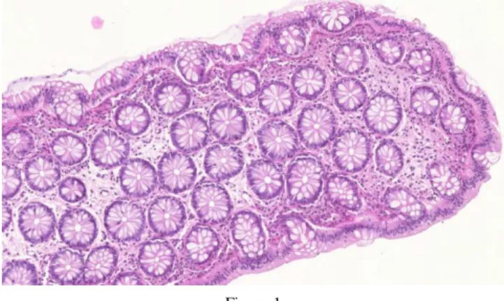 Figure 1  HE stained colon tissue 
