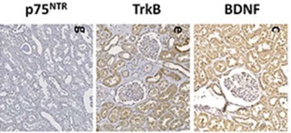 6. ábra Immunhisztológiai festés  p75Ntr,  TrkB  és  BDNF  mintákból  egészséges  humán  vesében 