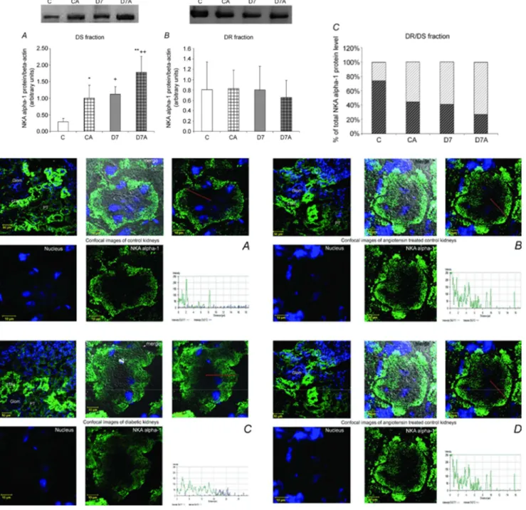 5. ábra Reprezentatív immunoblot és fluoreszcens immunhisztokémiai képek a Na+/K+-ATPáz α1 fehérjeszintek változása a szolubilis citoszól  (DS), és a membrán (DR) frakcióban  kontroll és diabéteszes kezeletlen és angiotenzin II-vel kezelt állatok vesejébén