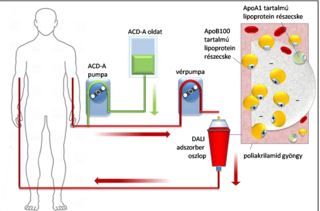 12. ábra. Az LDL hemoperfúziós módszert (direct adsorbtion of lipoproteins – DALI)  rendszer működésének vázlatos rajza 