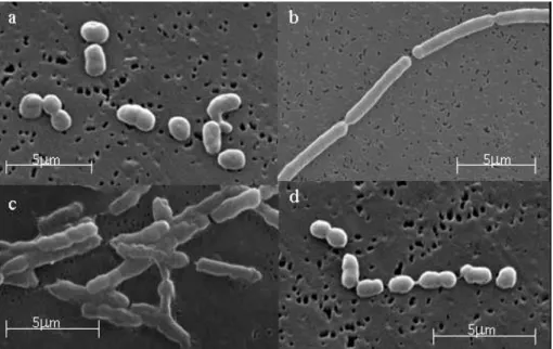 2. kép. A IV-75 T  baktériumtörzs morfológiai sejtciklusa, Fotó: Makk Judit 
