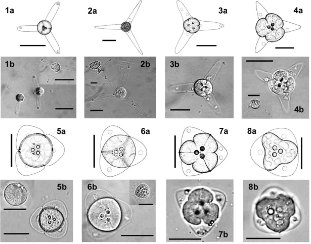 3.1. ábra:  A  felmérő  vizsgálat  során  Branchiura  sowerbyi  féregből  kimutatott  actinospóra  típusok