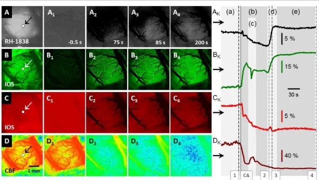 4.2.6. ábra. Reprezentatív képsorok a hirtelen szívmegállás (cardiac arrest, CA) és a terminális, terjedő  depolarizáció  (spreading  depolarization,  SD)  alatti  változások  szemléltetésére  a  négy,  párhuzamos  modalitással