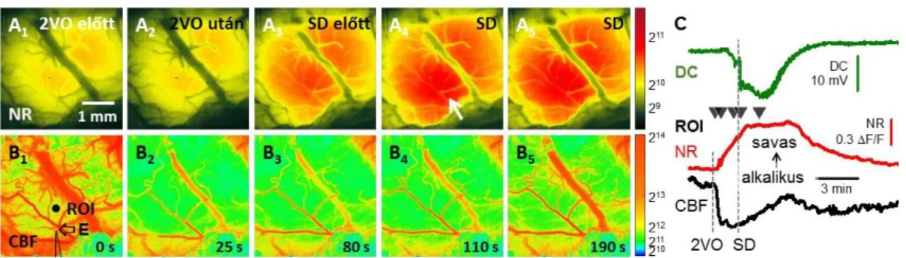 5.4.3. ábra. A nyers neutrálvörös (Neutral Red, NR) és lokális agyi vérátáramlás (cerebral blood flow, CBF)  képsorok,  azok  egy  meghatározott  pontjából  (region  of  interest,  ROI)  nyert  intenzitásgörbék,  és  a  beültetett  elektródával  elvezetett