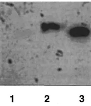 3.1.3. ábra. A sejtfelülúszókban lévő  32 P izotóppal jelzett fetuin-A autoradiográfiás képe