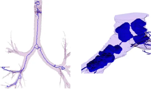 Figure 1.19: Topological kernels superimposed on incorrectly segmented 3D human airway trees