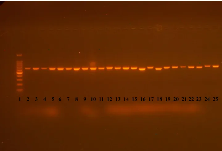 4. ábra. A rRNS gén nagy alegysége D1/D2 régiójának NL1 és NL4 indítószekvenciákkal  felszaporított DNS fragmentjei (Dlauchy Dénes felvétele) 