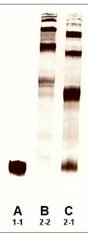 7. ábra. A különböző haptoglobin (Hp) fenotípusok elektroforetikus képe 