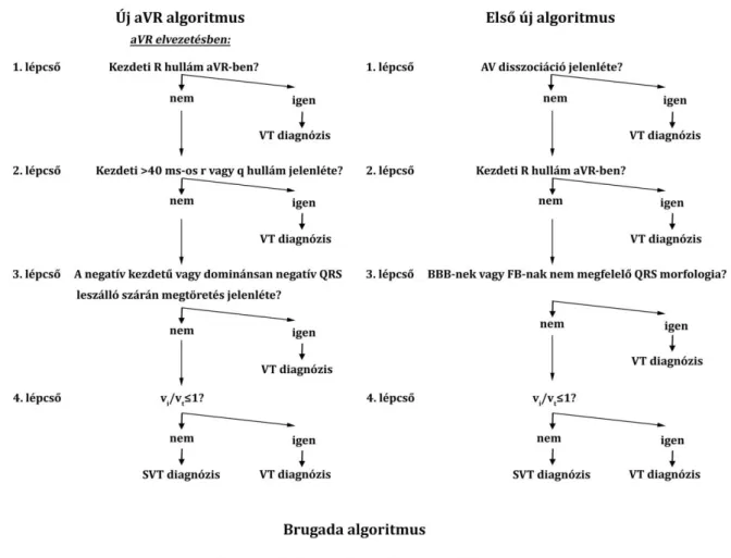 4. ábra Az új aVR algoritmus, az első új algoritmus és a Brugada algoritmus.  