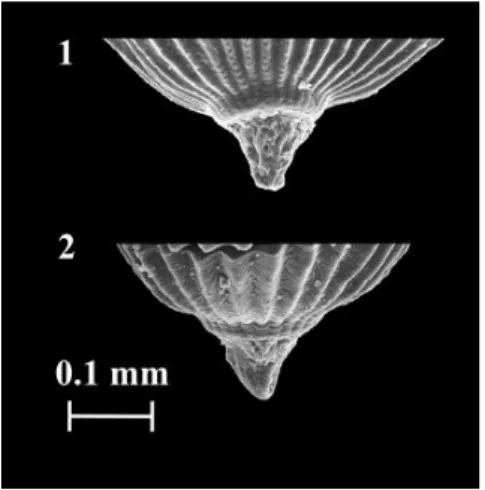 3.3. ábra: a Knoblochia sp. nov. egy galléros mikropile régiójának pásztázó elektronmikroszkópos felvétele  (Vaşile Ştefan és Bodor Emese felvétele) 