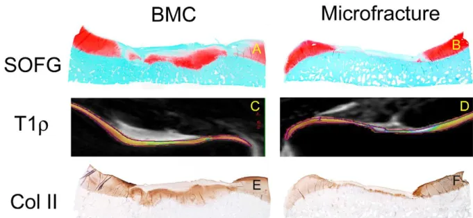 6. ábra. Lovak laterális trochleáján készített 15 mm-es defektusok mikrofraktúra+BMAC  (bal oldal)  kezelése  összehasonlítva  a  kizárólag  mikrofraktúra  kezeléssel  (jobb  oldal)