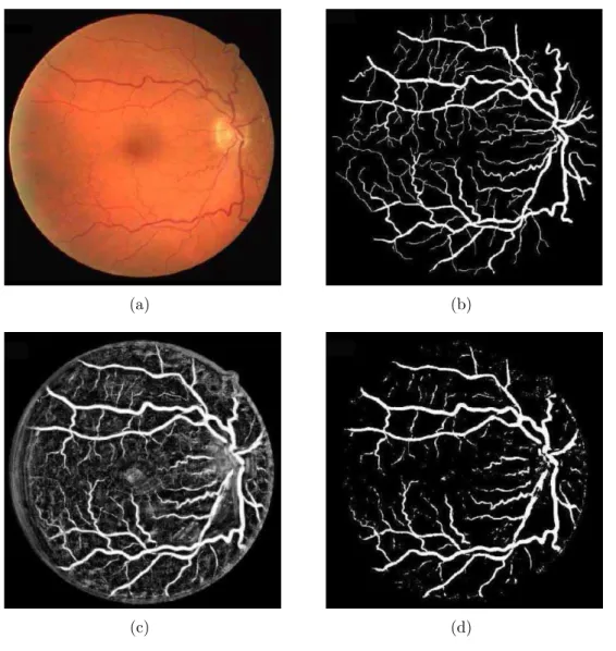 Figure 2.22: Components of a learning-based vessel segmentation algorithm; (a) input retinal im- im-age, (b) manual segmentation for training, (c) confidence values to classify as vessel, (d) segmented vascular system.