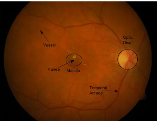 Figure 2: A sample fundus image with the main anatomical parts annotated.