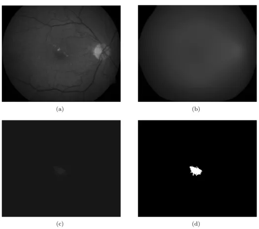 Figure 3: Steps of the proposed macula detection: (a) The green channel of the input image