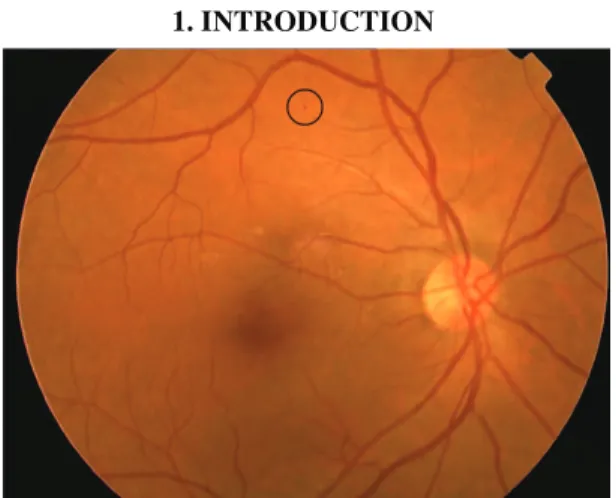 Fig. 1. Retinal image with microaneurysm marked. 