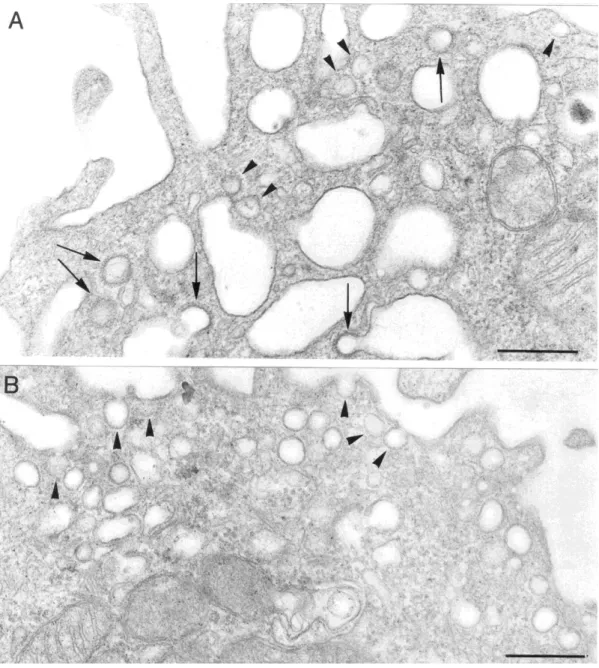 10. ábra: Rezidens (A) és elicitált (B) makrofág citoplazmájának részlete. A.) A  clathrin-burkos vezikulumok nagy számban vannak jelen a sejtmembránon ill