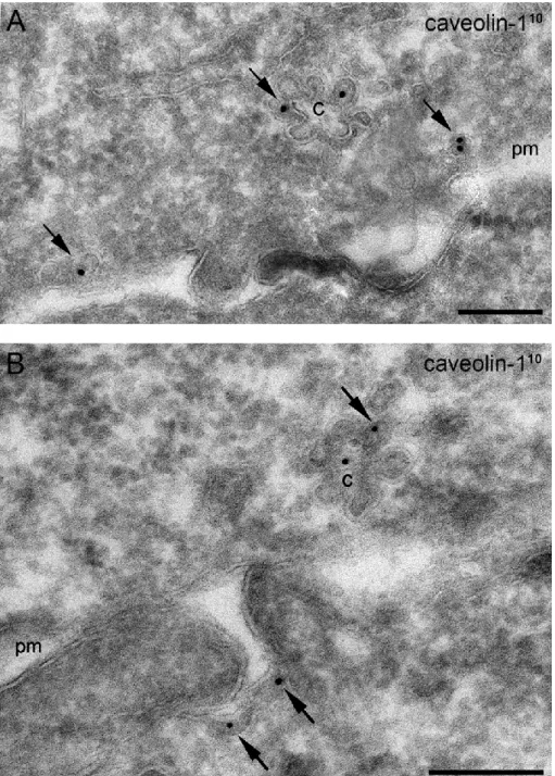 37. ábra: Okadánsav kezelés után rozetta formájú organellumok (caveoszómáknak  tartott  struktúrák)  jelenléte  HepG2  sejtekben