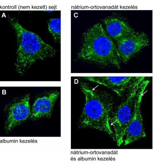 39. ábra: Albumin és nátrium-ortovanadát kezelés hatása a caveolin-1 eloszlására  HepG2 sejtben