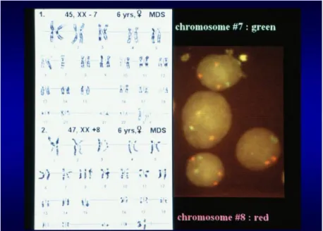 1.1.2. ábra A humán 28S rRNS antisense próbával hibridizált kontrol (A) valamint hemin (B)  és forbol-mirisztát-acetát (PMA) (C) kezelt sejtek fluoreszcens mikroszkópos képe