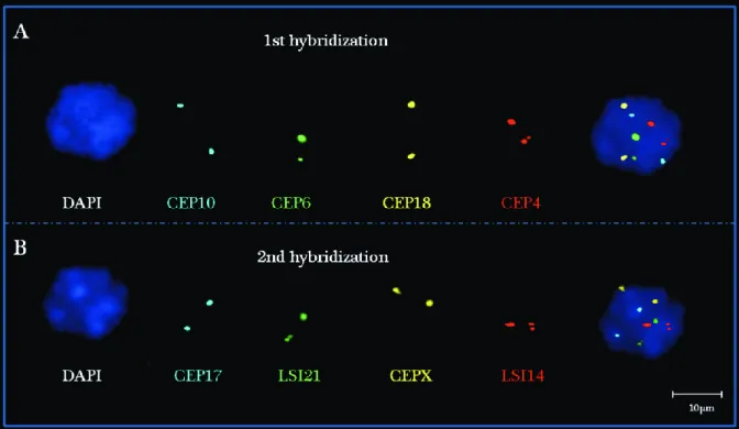 3.1.1. ábra A target sejt egymást követő, 2 x 4 iFISH jelölése. A az első próbaszet (CEP szet)   –  CEP4  (vörös),  CEP6  (zöld),  CEP10  (aqua),  CEP18  (arany);  B  ugyanazon  target  rehibridizációja  a  2