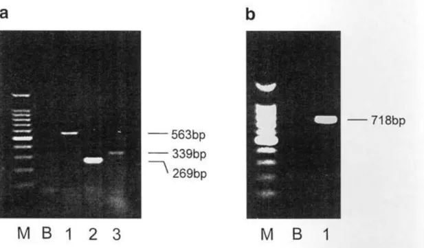 18. ábra (a, b). Neuropeptid Y Y 1 , Y 2  (NPY Y 1,  Y 2 ), vasoactiv intestinalis polipeptid 1 (VIP 1 ) és calcitonin génnel-rokon peptid 1  (CGRP 1 ) receptor mRNS analízis a humán 