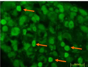 26. ábra. A szervtenyészetbe vitt patkány ganglion trigeminale-ban (TRIG) a P-anyag  (SP) immunreaktivitása 