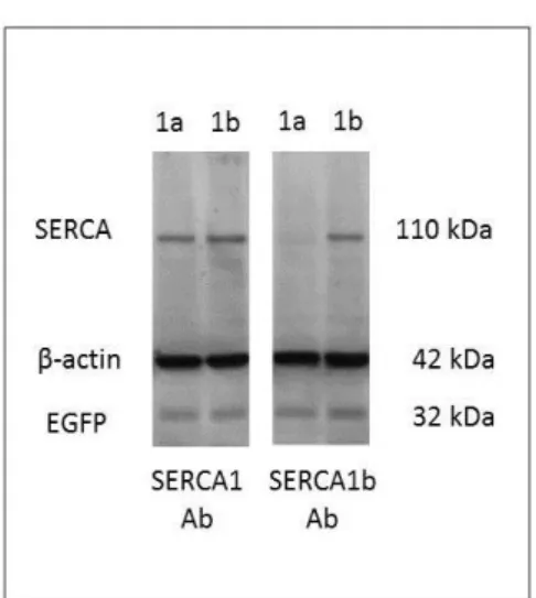 4. Ábra: Egy pan SERCA1 Ab (A53) SERCA1a  specifitásának  hiánya.  A  SERCA1b  specifikus  Ab  a  jobb  oldali,  a  SERCA1  Ab  a  bal  oldali  immunoblotton