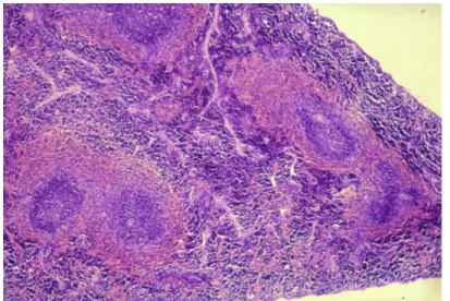 19. ábra: Lymphoid hiperplázia a Malpighi testekben és sejtben gazdag  vörös pulpa a DNT− B