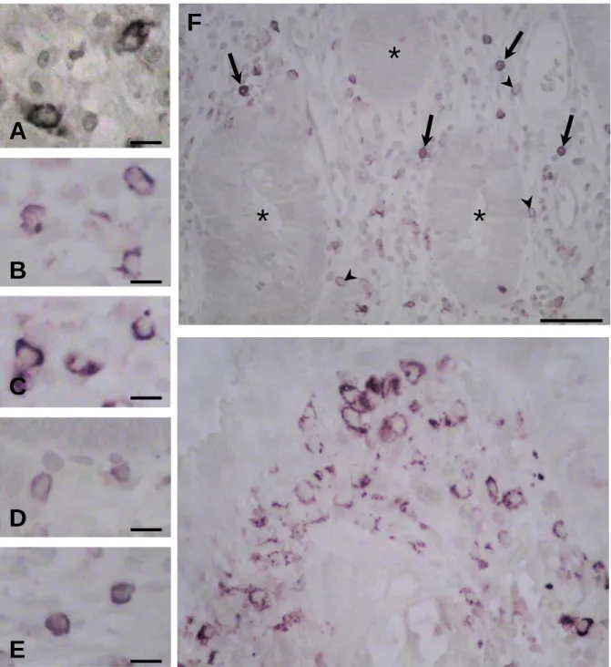3. Ábra. Az iNOS-IR sejtek  sejttípusának  meghatározása  paraffinba ágyazott IBD-s biopsziákon