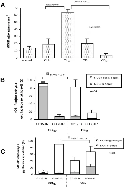 4. Ábra  Az iNOS-IR sjtek  kvantitatív értékelése (A)  és sejttípusának  meghatározása UC (B) és CD (C) esetében